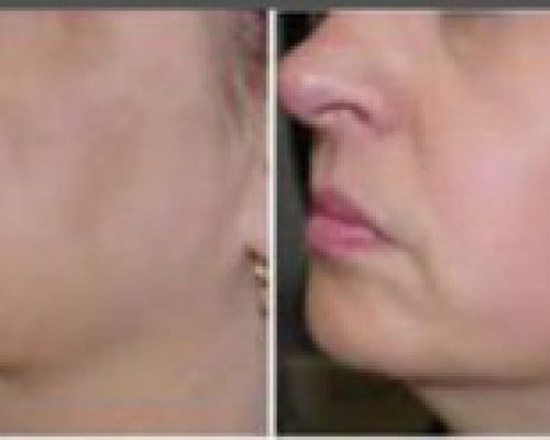 FullSizeRender-20-300x124